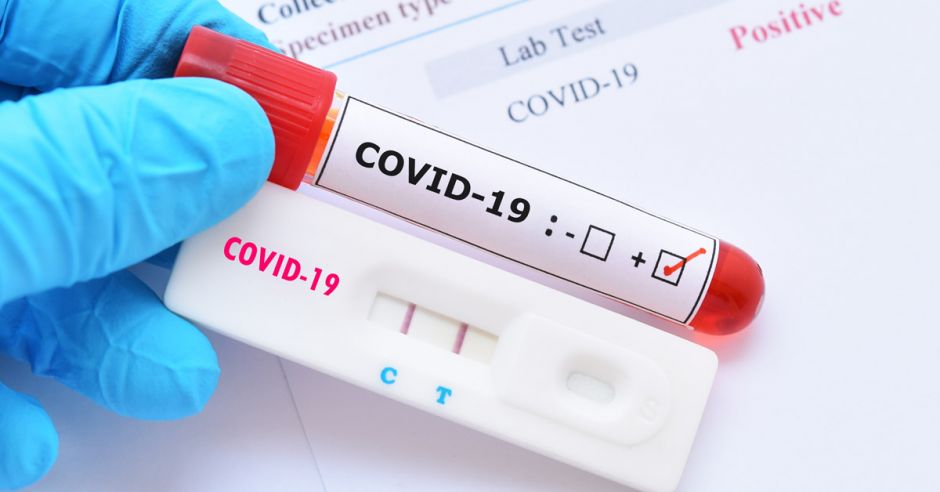 COVID-19: Confirman 4 nuevos fallecidos en Paraguay y 285 nuevos contagiados
