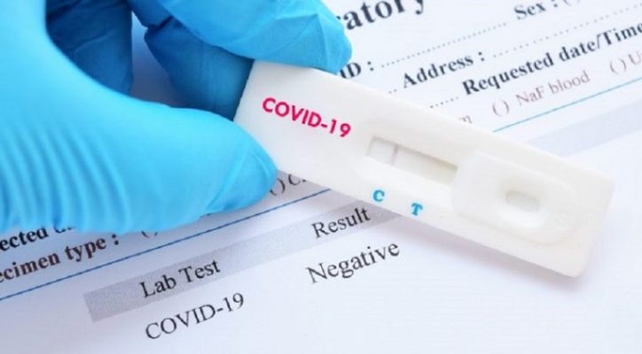 COVID-19 en Paraguay: Reportan dos fallecidos y 69 nuevos positivos
