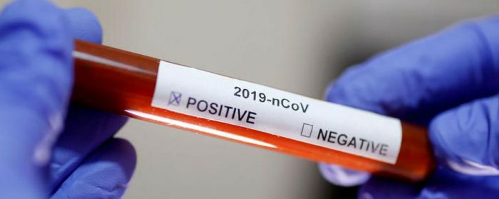 Amnistía denuncia «tácticas represivas» en países americanos durante pandemia