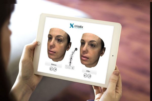 Implementan inteligencia artificial para reconstruir cuerpo post cirugía de pacientes